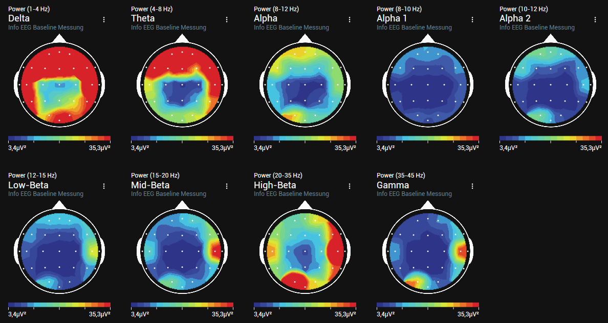 EEG Gehirnscan - Neuron BrainScan